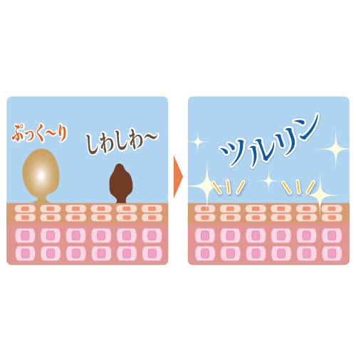 イポロン G 3