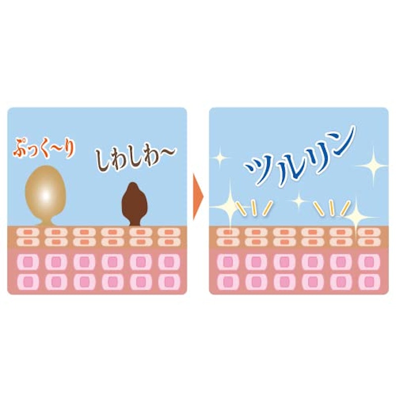イポロン G 3