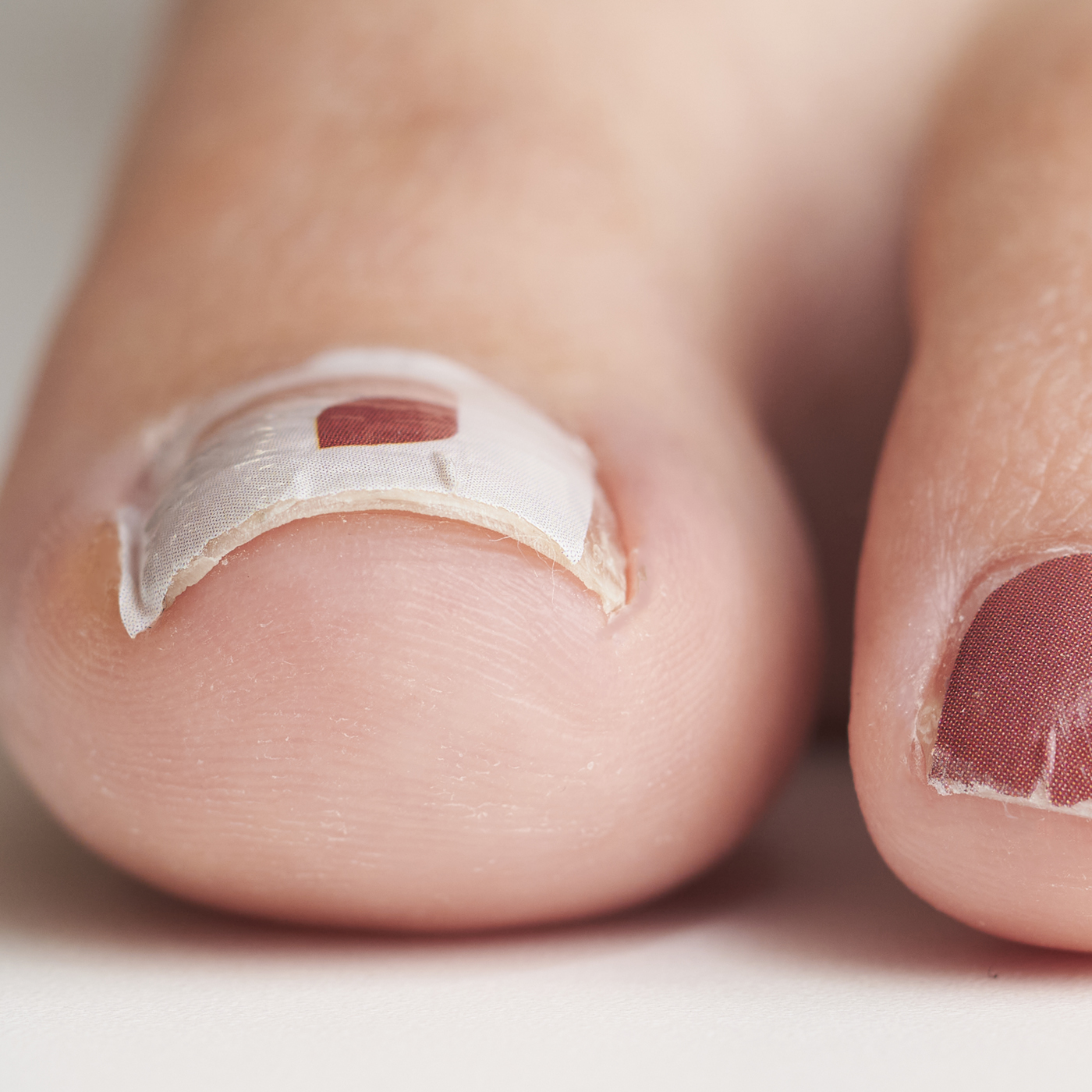 Handmade Amane 貼るだけ簡単フットネイルシールを全9商品と比較 口コミや評判を実際に使ってレビューしました Mybest