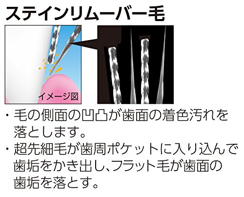 歯の美白 4
