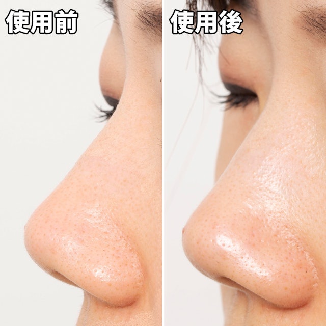 毛穴さわやか黒いパックを他商品と比較 口コミや評判を実際に使ってレビューしました Mybest 毛穴さわやか黒いパックを他商品と比較 口コミや評判を実際に使ってレビューしました Mybest