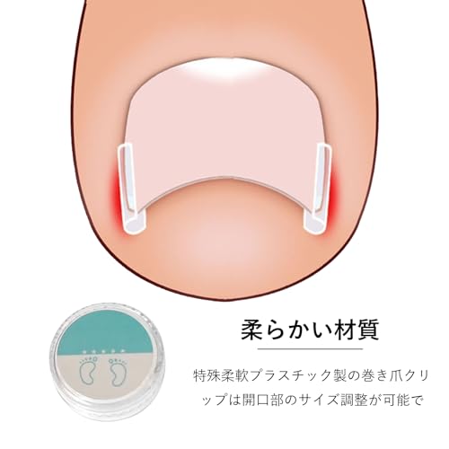 巻き爪クリップ 5