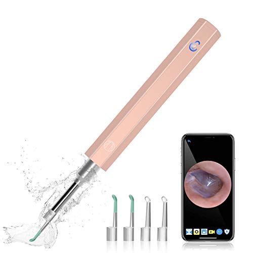 21年 イヤースコープのおすすめ人気ランキング9選 Mybest