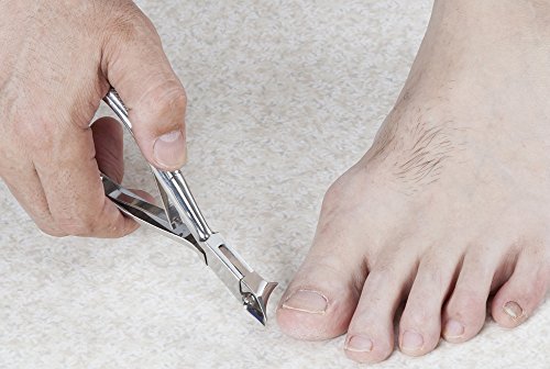 22年 巻き爪用爪切りのおすすめ人気ランキング10選 切りにくくても安心 Mybest