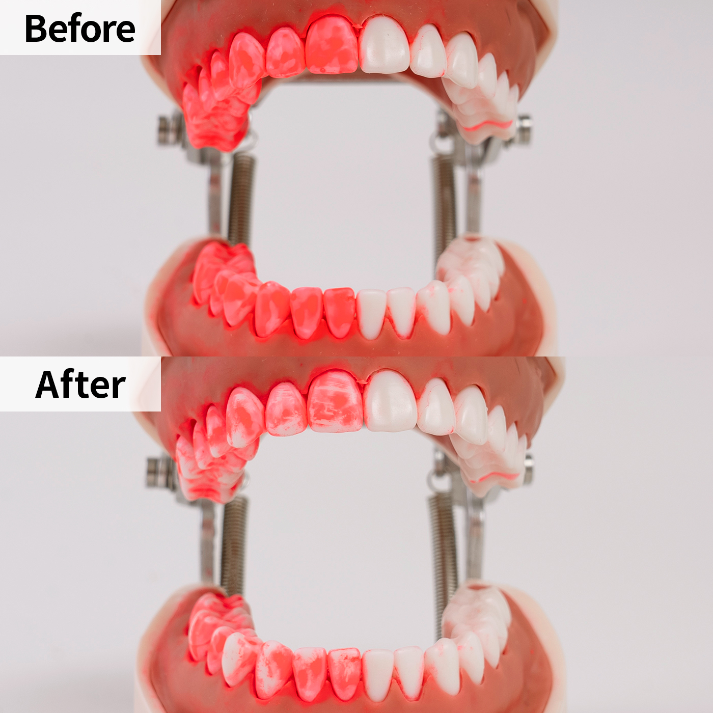 フィリップス ソニッケアーパワーフロッサー3000をレビュー