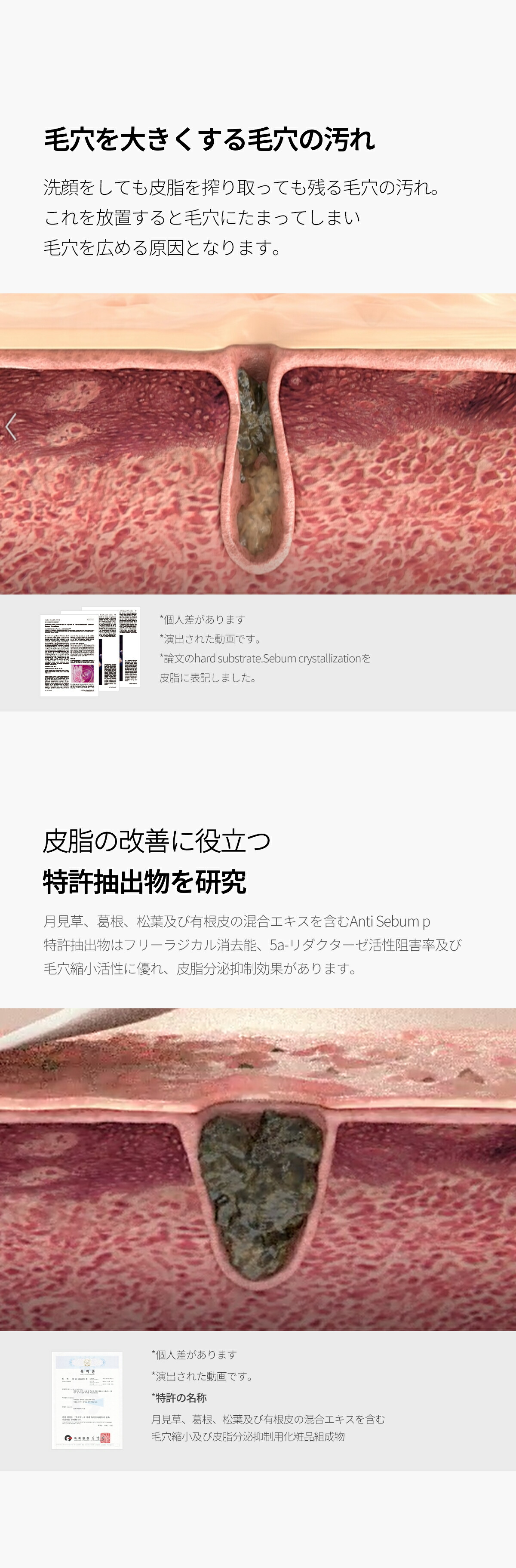 ゼロ毛穴パッド 2.0 マイルド 3