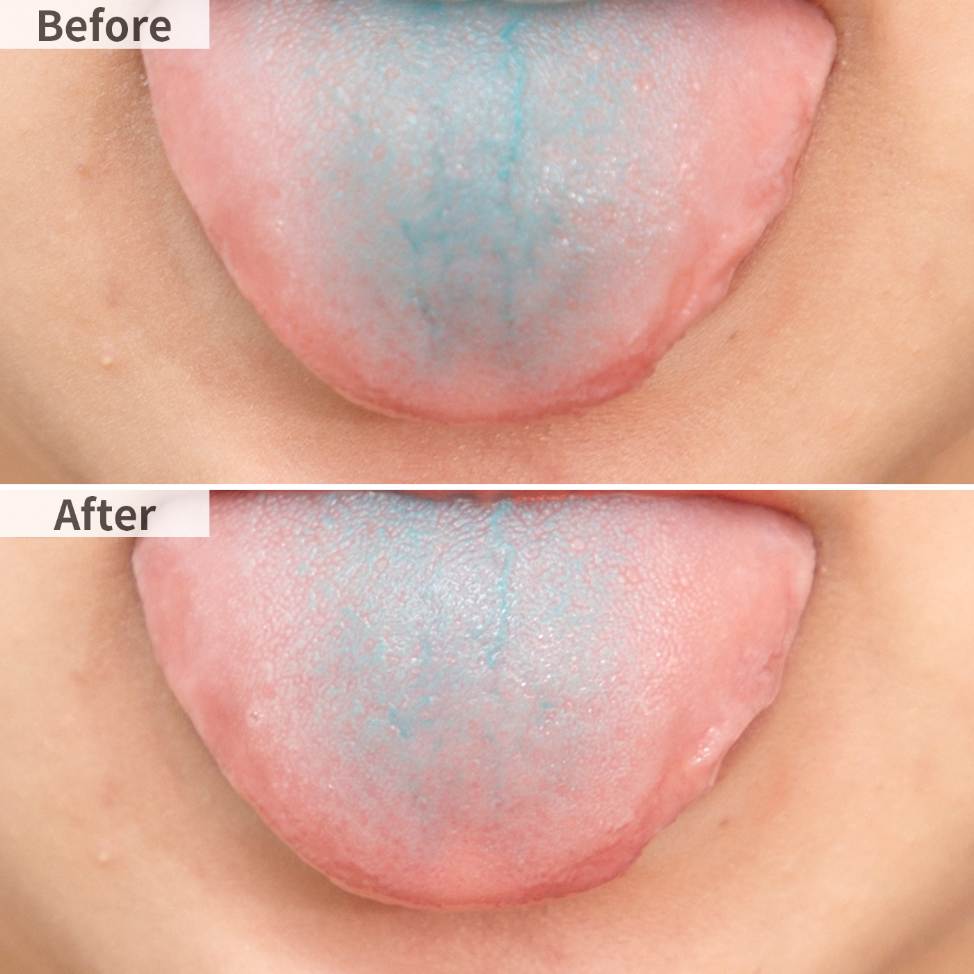 レーベン ののじ ソフト舌クリーナーを他商品と比較 口コミや評判を実際に使ってレビューしました Mybest