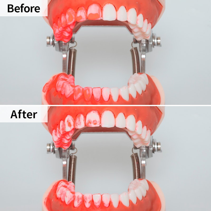 口内クリーナー DENTAL WASHER 4