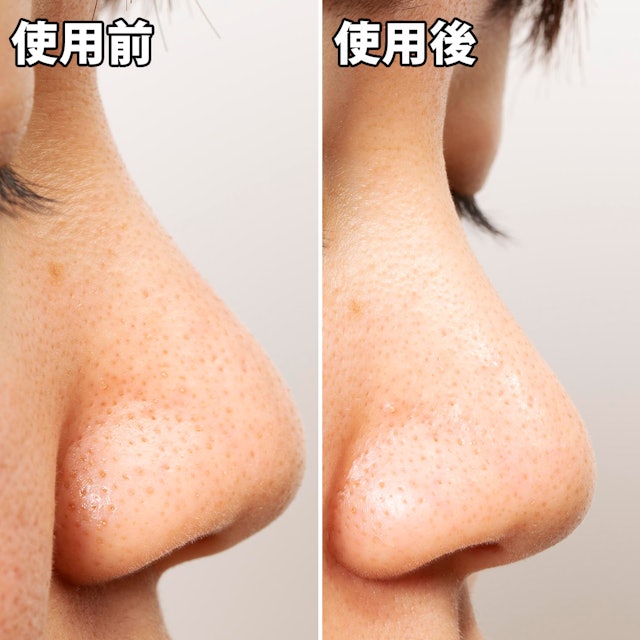 ポアトル すっきりシートパックを全18商品と比較 口コミや評判を実際に使ってレビューしました Mybest ポアトル すっきりシートパックを全18商品と比較 口コミや評判を実際に使ってレビューしました Mybest