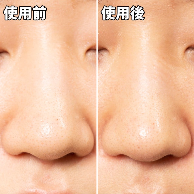Matsukiyo 毛穴パック炭を他商品と比較 口コミや評判を実際に使ってレビューしました Mybest Matsukiyo 毛穴パック炭を他商品と比較 口コミや評判を実際に使ってレビューしました Mybest