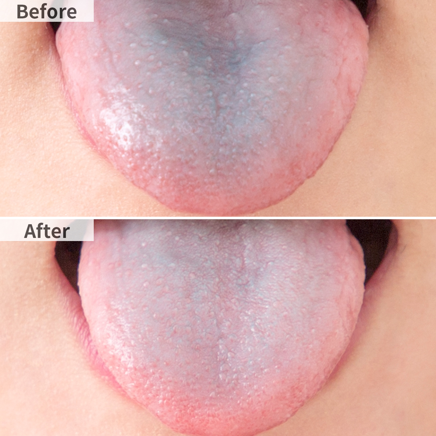 ドクターデンリスト 舌ブラシを他商品と比較 口コミや評判を実際に使ってレビューしました Mybest