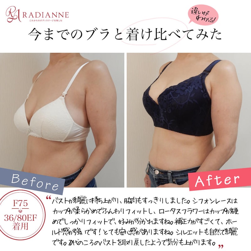 ラディアンヌ リフトアップロータスフラワー 12