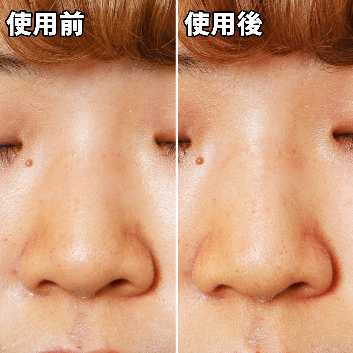 メンズ ソフティモ 黒パック すべすべ 鼻用 薬用 皮脂 Softymo 肌荒れ 角質ケア 小鼻 汚れ 10