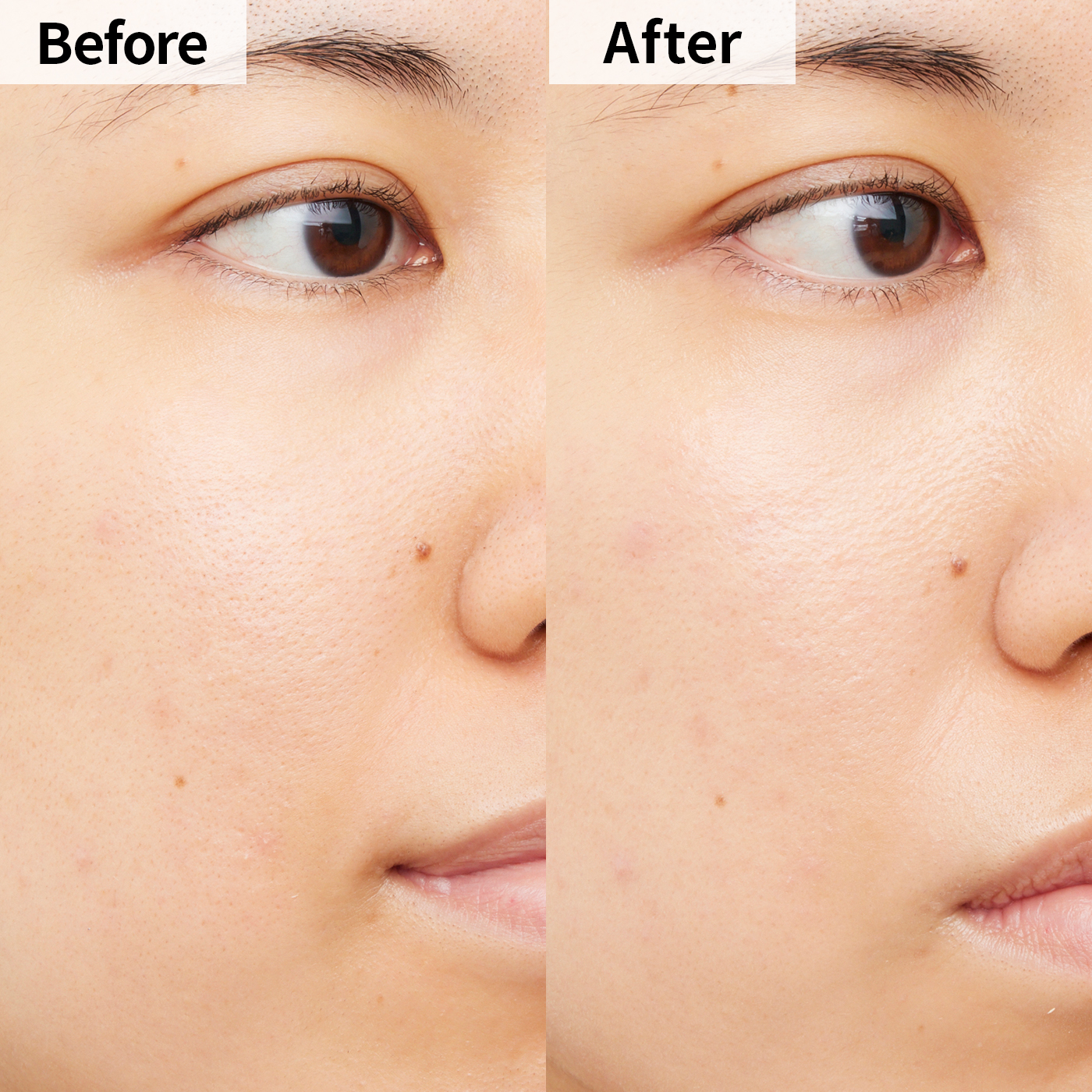 山野愛子どろんこ美容 シドナス Kプラス ウォーターファンデーションを