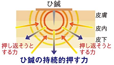 イージー鍼治療 ひ鍼家庭用 7
