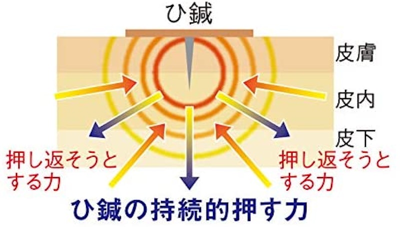 イージー鍼治療 ひ鍼家庭用 7