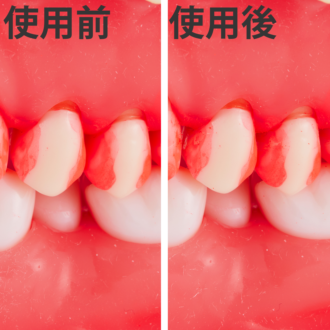 歯間ブラシL字型 6