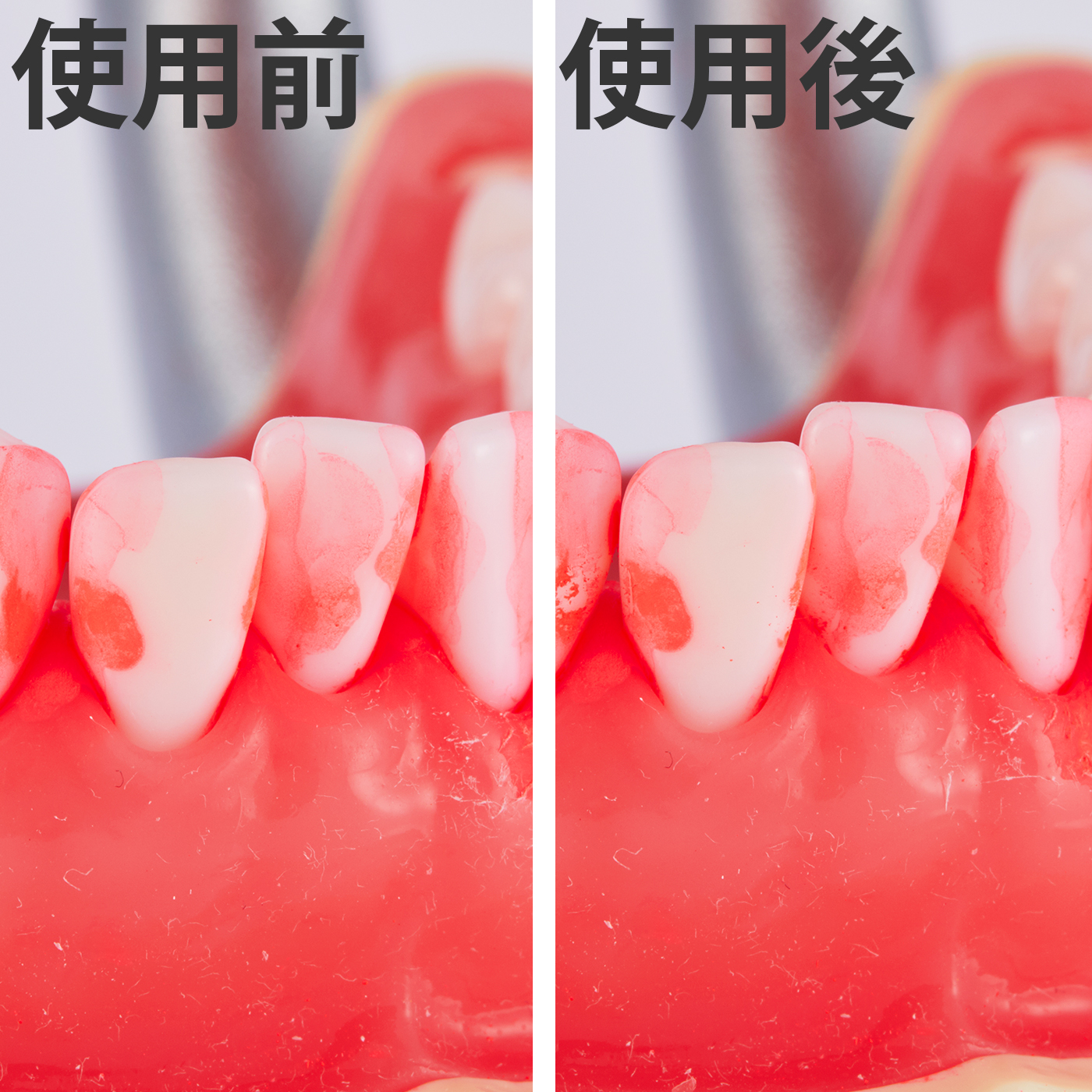 歯間ブラシL字型 7