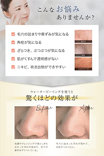 ウォーターピーリング 美顔器 5