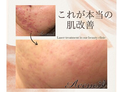 肌トラブル改善専門店 Accueil 2