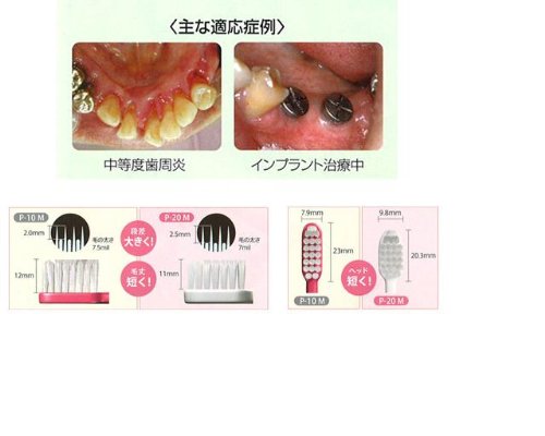 ルシェロ P-10 歯ブラシ 5本  5
