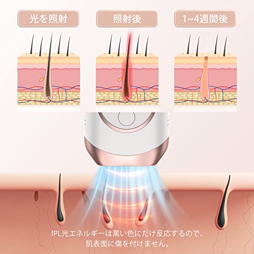 脱毛器 7