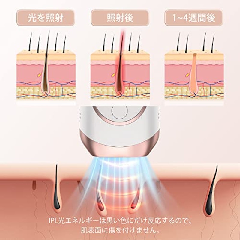 脱毛器 7