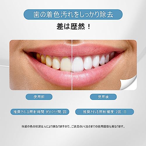 ホワイトニングLEDライト 3