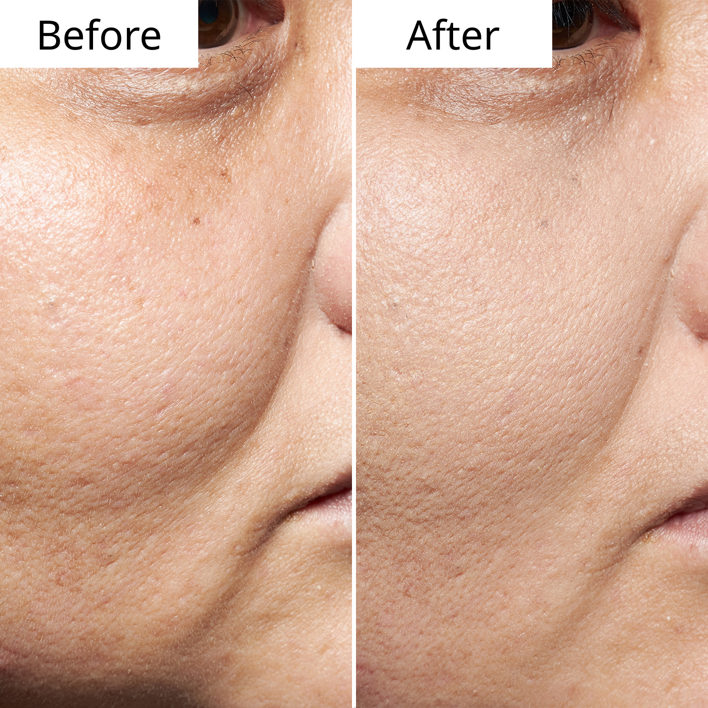 資生堂 クレ・ド・ポー ボーテ タンフリュイドエクラ ナチュレルを検証