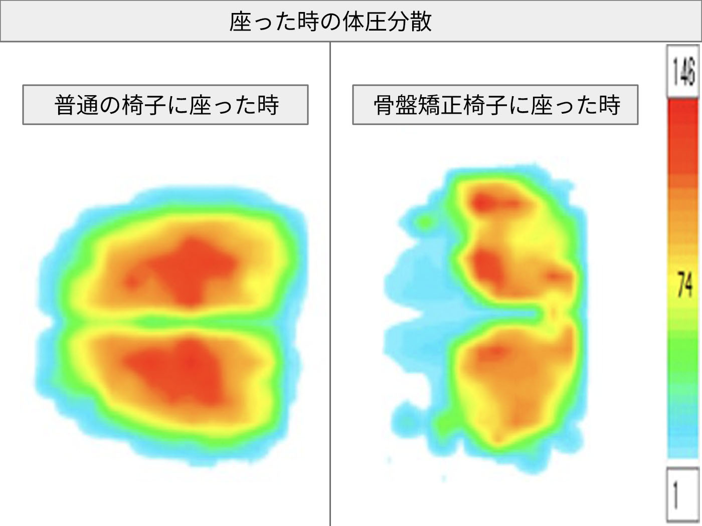 cecil-shape 4