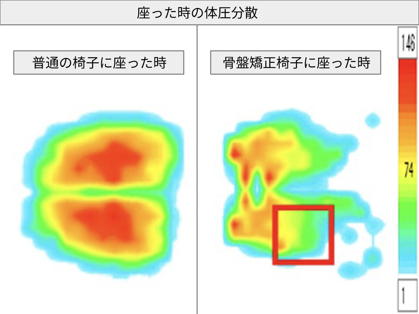 ジュート Backjoy メディコアポスチャー 2.0 クチコミ評価・評判&検証