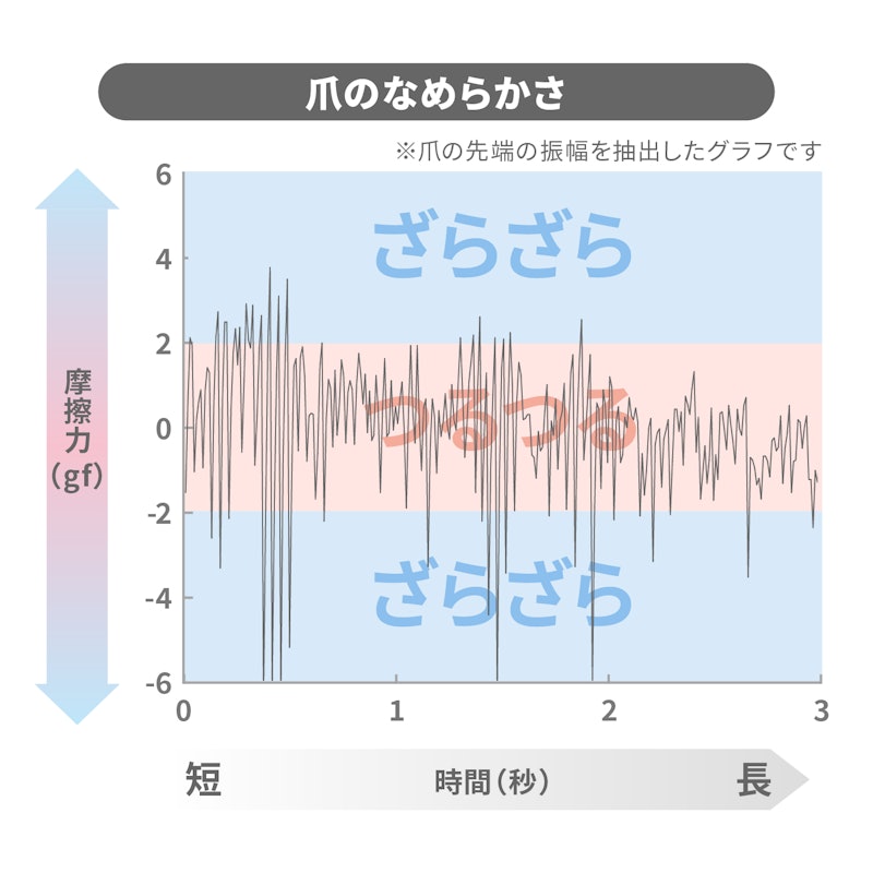 SUWADA つめ切り CLASSIC(L) 2