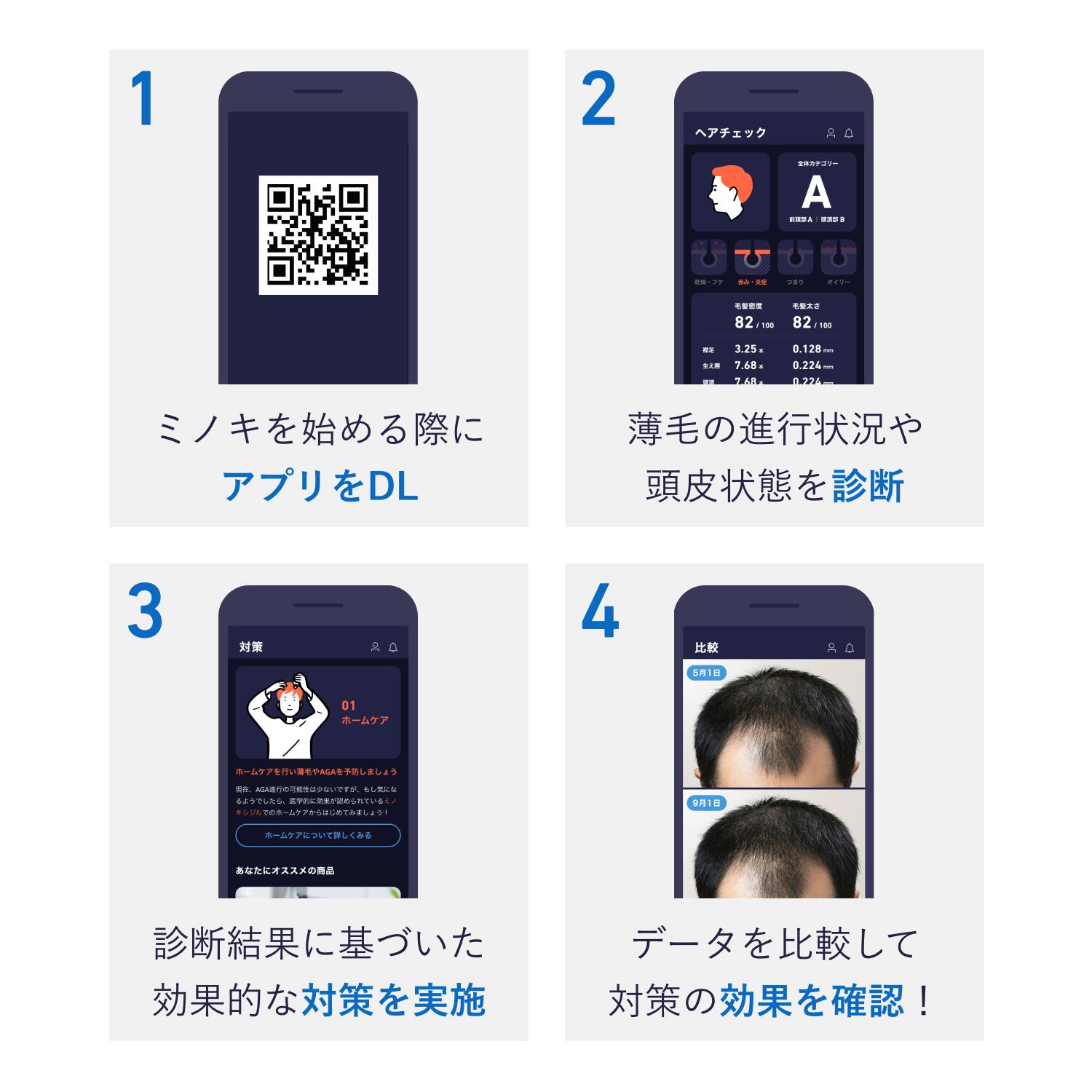 ミノキシジル5 6