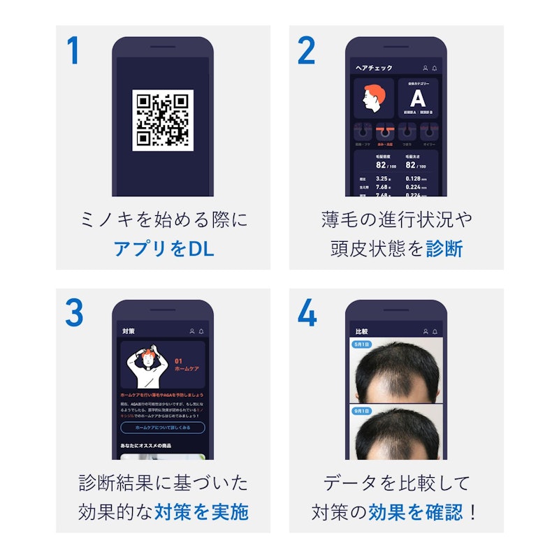 ミノキシジル5 6