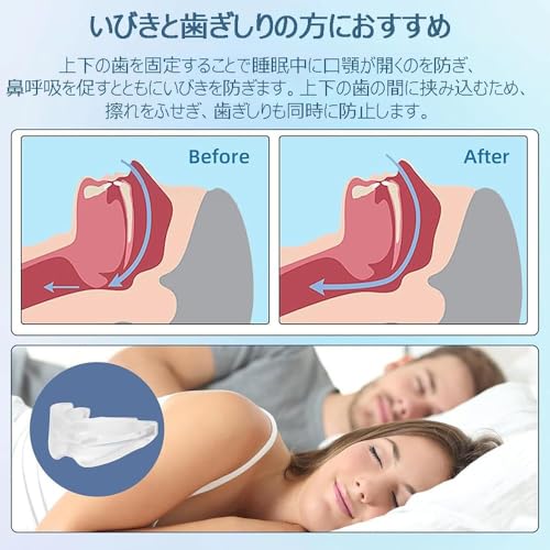 マウスピース 2