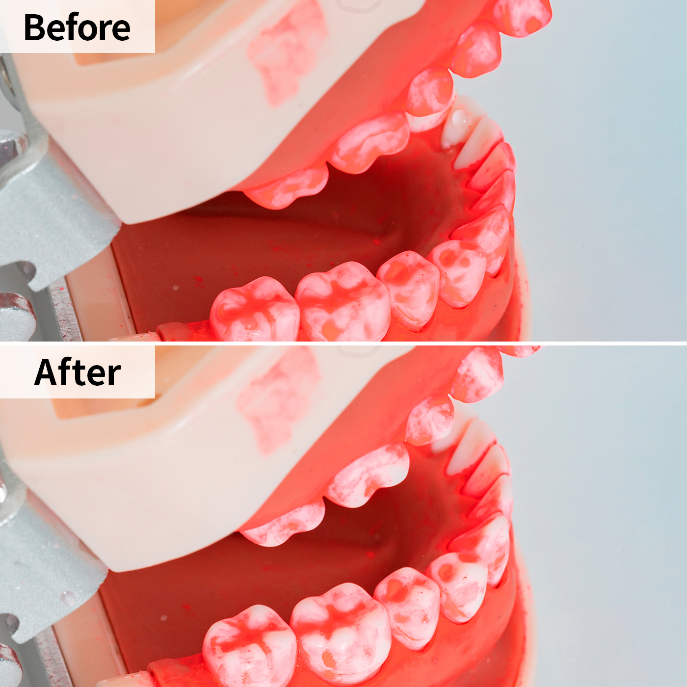 口内クリーナー DENTAL WASHER 6