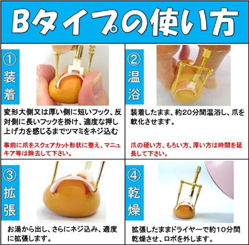 巻き爪ロボ 5