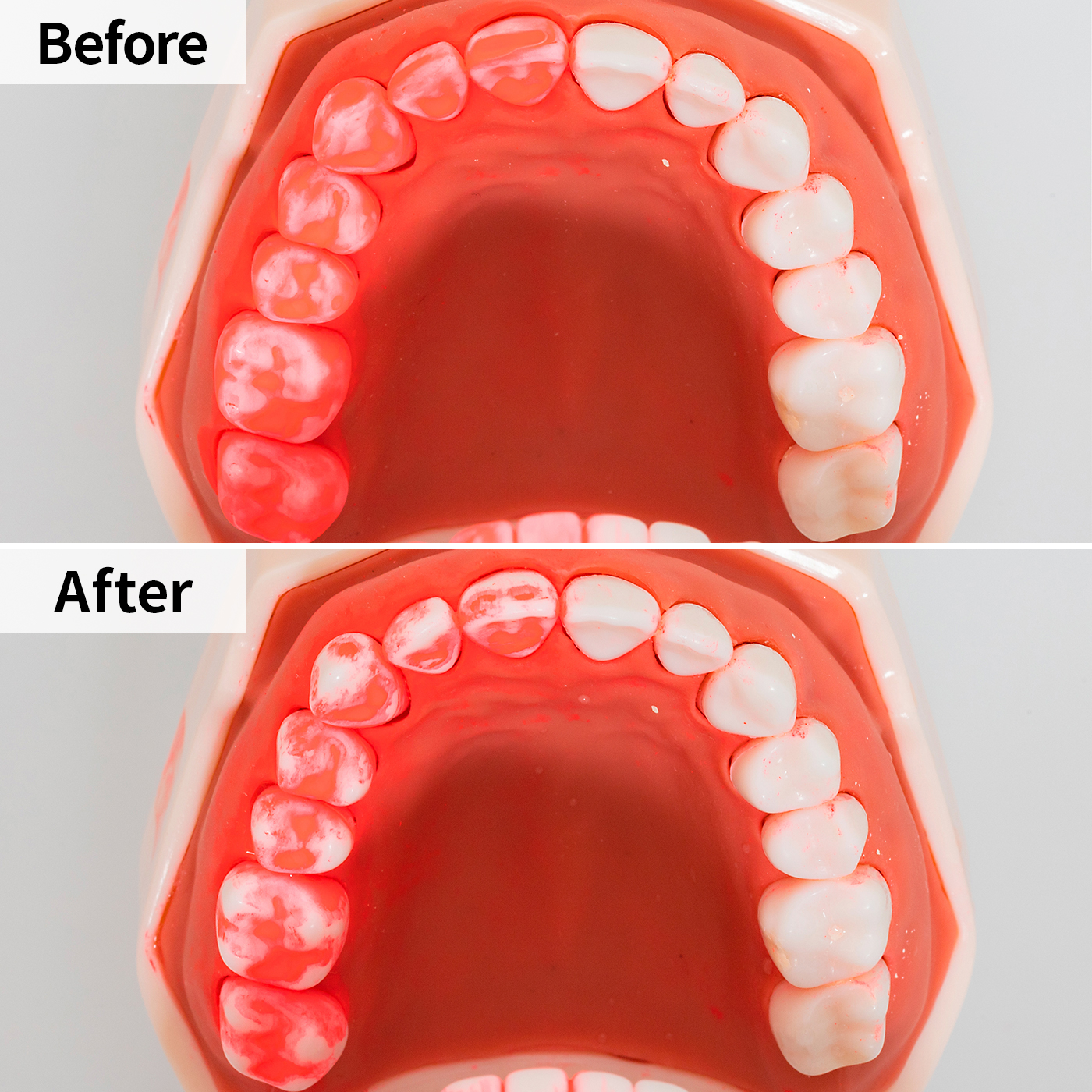 口内クリーナー DENTAL WASHER 7