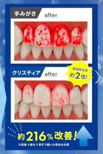 ホワイトエッセンス クリスティアを検証レビュー！電動歯ブラシ