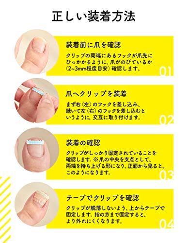 巻き爪クリップ 6