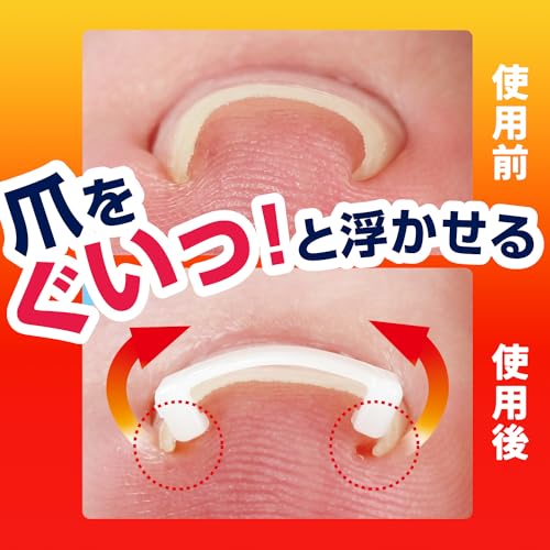 巻き爪フックシール 6