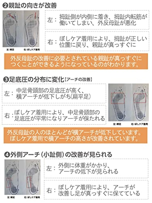 5本指 ソックス 5