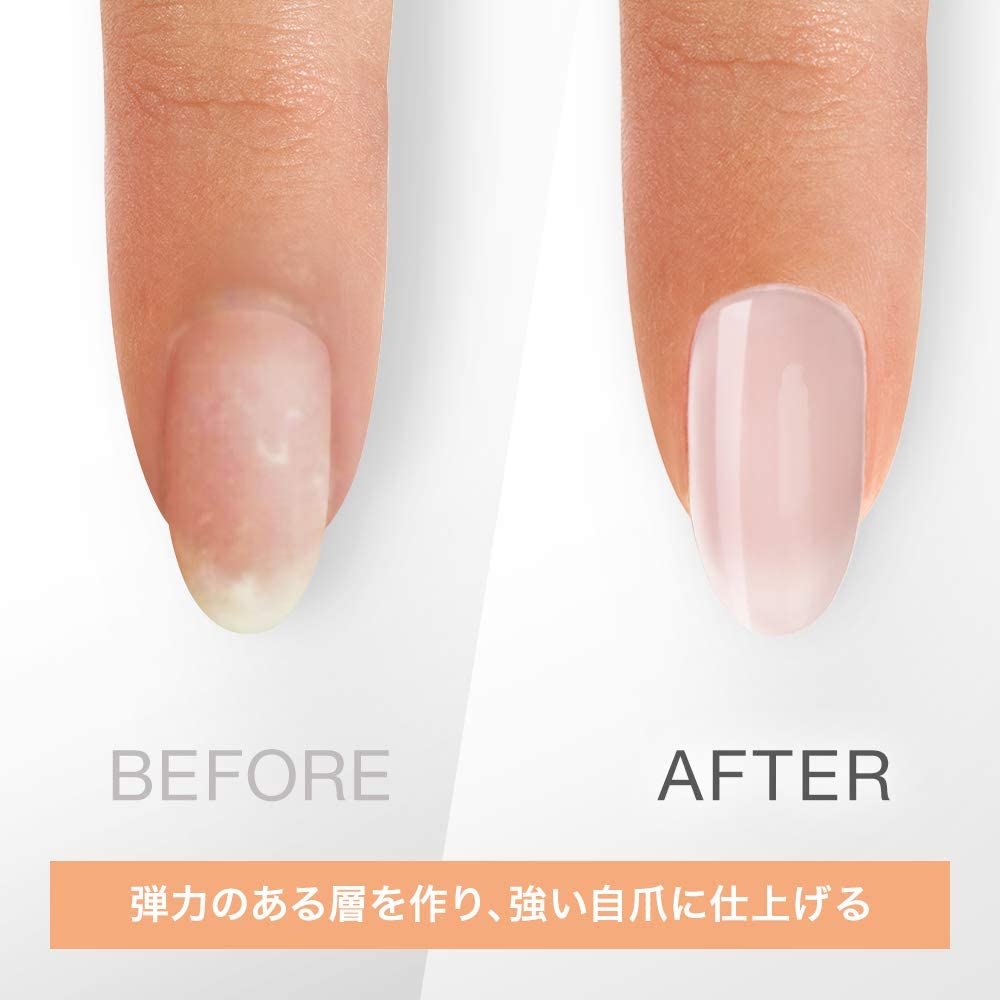 ネイルエンビ― 5