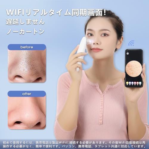 家庭用キャビテーション機器 自宅用キャビテーション機器のおすすめ人気ランキング【2026年5月