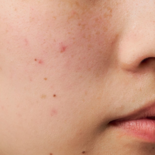 2021年】ポイントマジックPRO ポアカバーを全32商品と比較！口コミや 