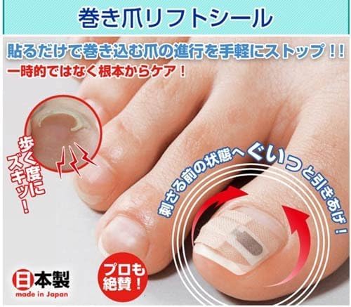  巻き爪リフトシール 3