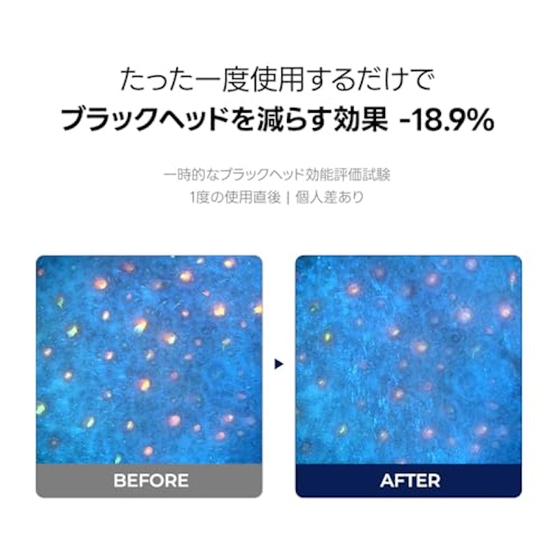 P.Z. SSOC SSOC ノーモアブラックヘッド 4