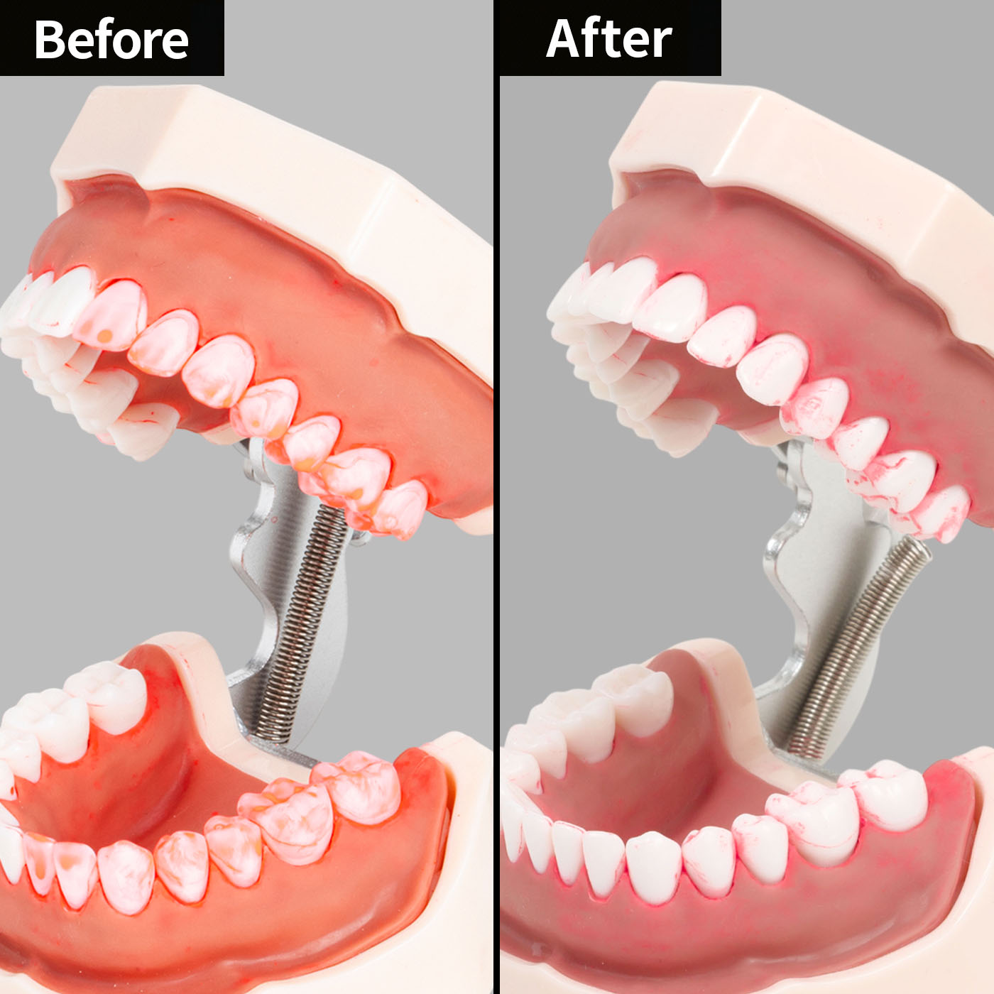奥歯PROハブラシ 4