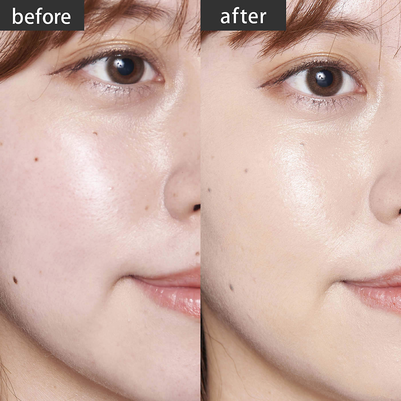 徹底比較 ニキビ肌向けファンデーションのおすすめ人気ランキング12選 カバー力が高いのは Mybest