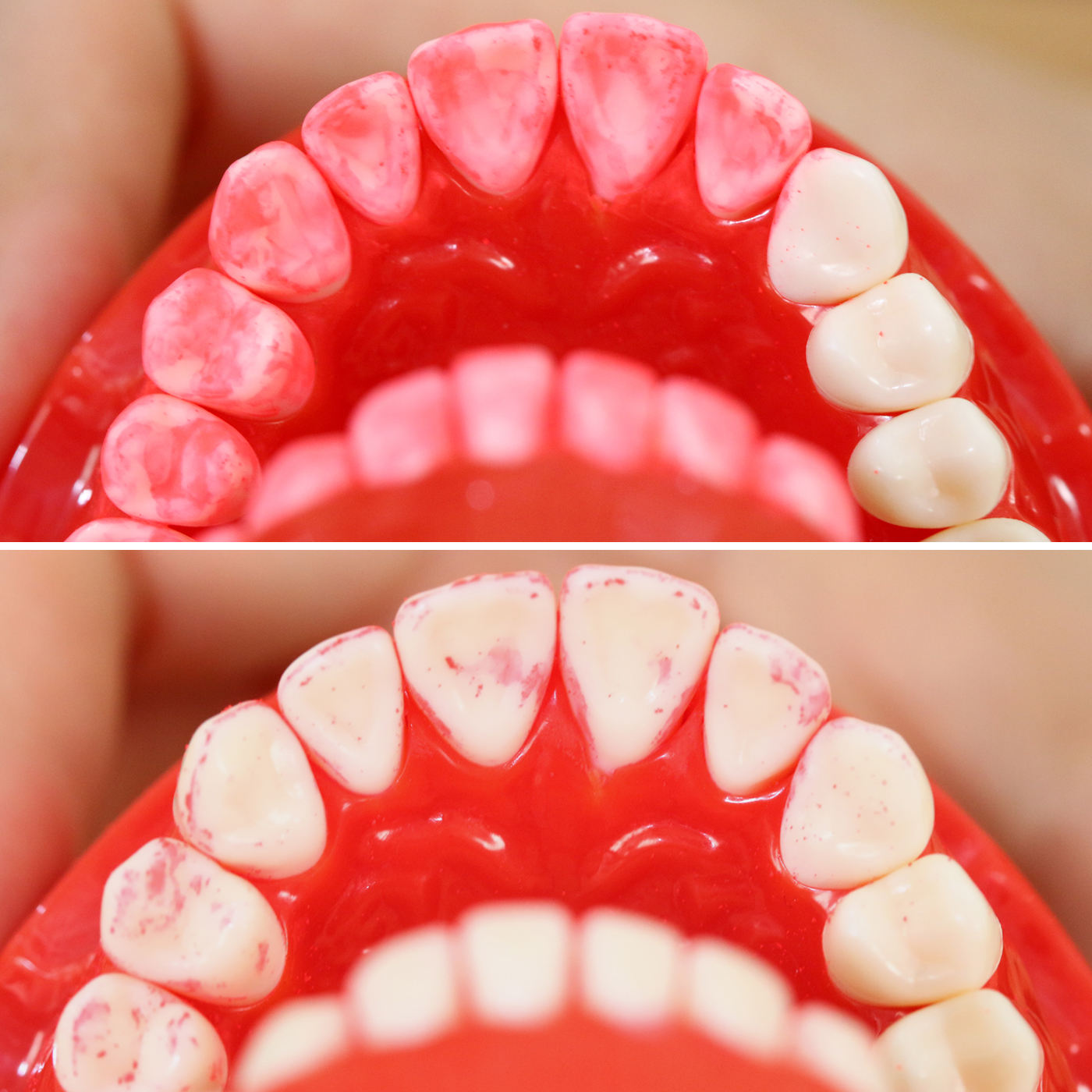 フィリップス ソニッケアー ダイヤモンドクリーンスマートを他商品と比較 口コミや評判を実際に使ってレビューしました Mybest